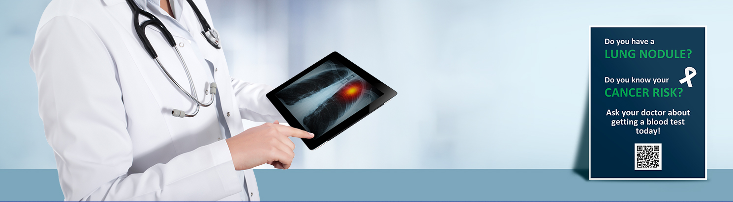 Nodify Lung® Nodule Risk Assessment